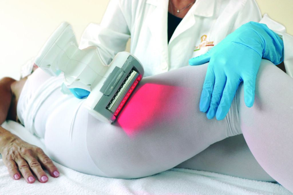 Trattamento di massaggio endodermico a rulli su coscia donna